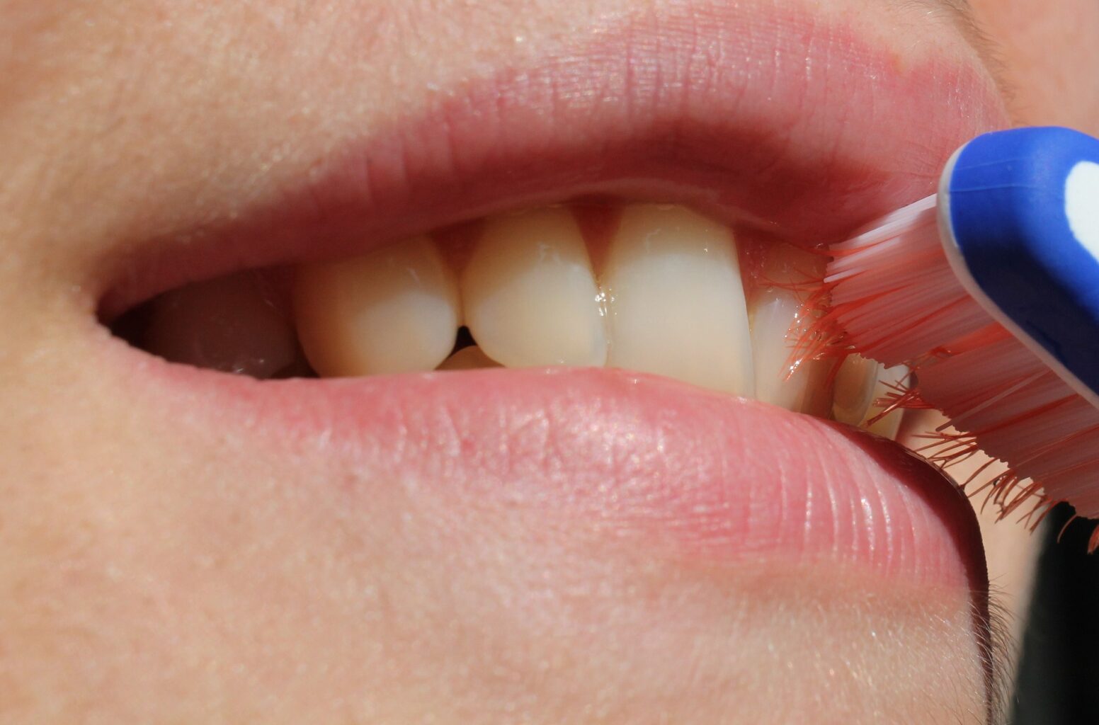 10 mitos sobre los dientes