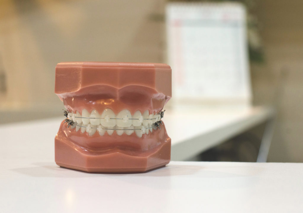 Tipos de ortodoncia en Córdoba - Clínica Dental PCM