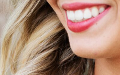 ¿Cómo se hace un blanqueamiento dental?