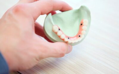 ¿Qué problemas pueden ocasionar los implantes dentales?