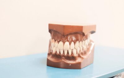 ¿Qué es la anodoncia?