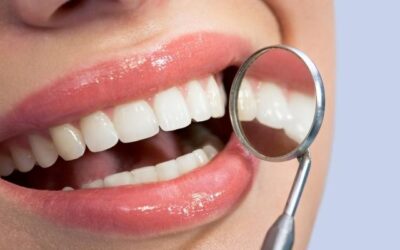 Tipos de manchas dentales y cómo eliminarlas