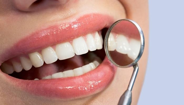 Tipos de manchas dentales y cómo eliminarlas