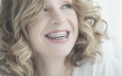 Cómo limpiar tu ortodoncia