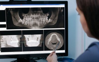 ¿Por qué se mueven los dientes?