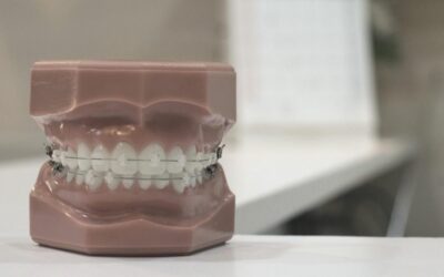 Problemas con la ortodoncia durante el confinamiento