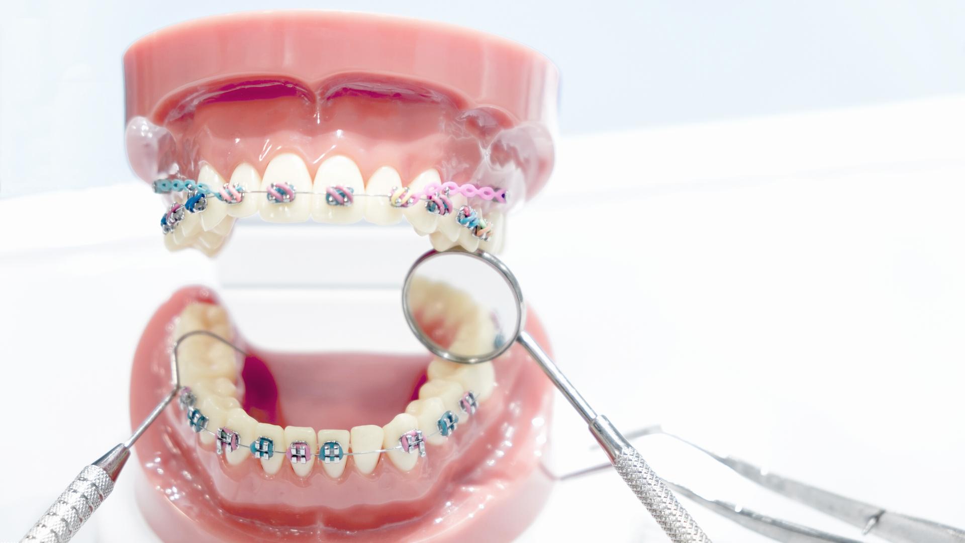 Diferencia entre odontólogo y ortodoncista
