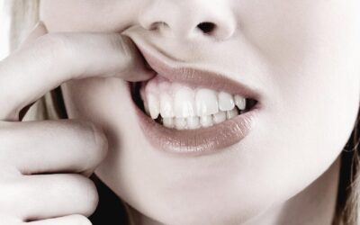 Causas de las encías negras