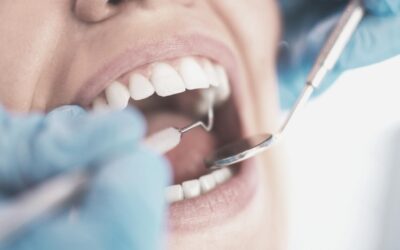 ¿Es posible regenerar las encías?