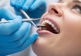 implantología dental en Córdoba - clinica pcm