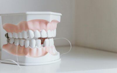 Me chocan las muelas: causas y qué hacer cuando los dientes no encajan bien