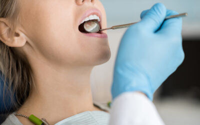 ¿Cuál es el precio de implantes de carga inmediata?