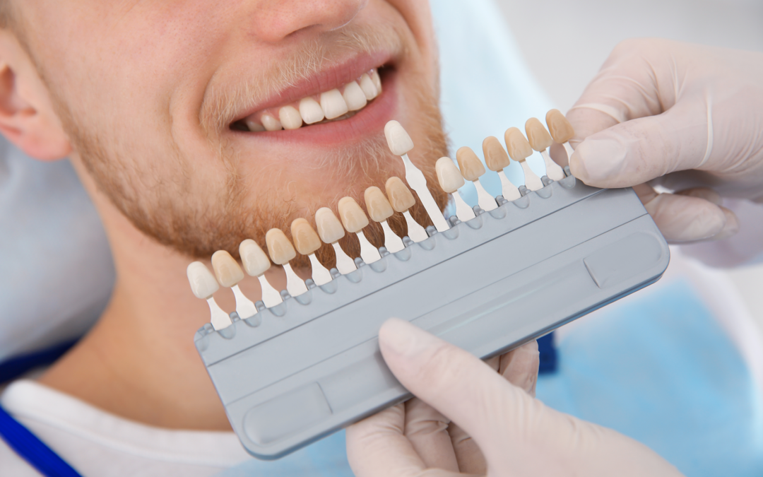 precio de las carillas dentales